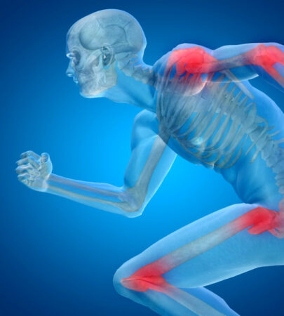 Orthopedics