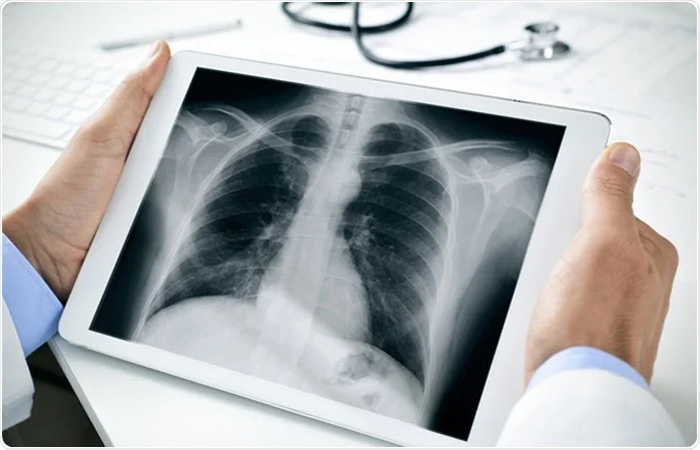 Digital X-RAY